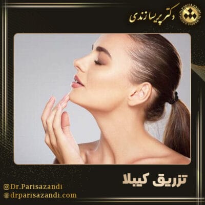 تزریق کیبلا