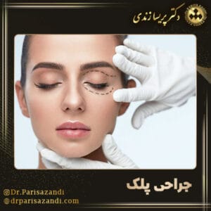 جراحی پلک - دکتر پریسا زندی