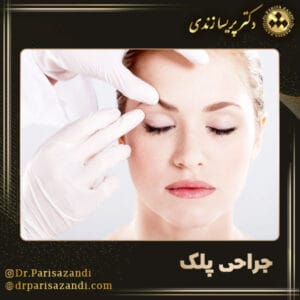 جراحی پلک - دکتر پریسا زندی