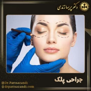 جراحی پلک - دکتر پریسا زندی