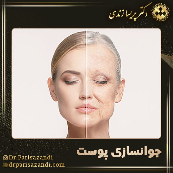 عکس جوانسازی پوست - دکتر پریسا زندی