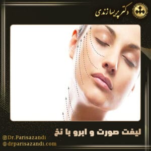 لیفت صورت و ابرو با نخ