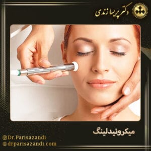 میکرونیدلینگ - دکتر پریسا زندی