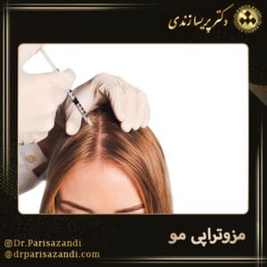 مزوتراپی مو - دکتر زندی