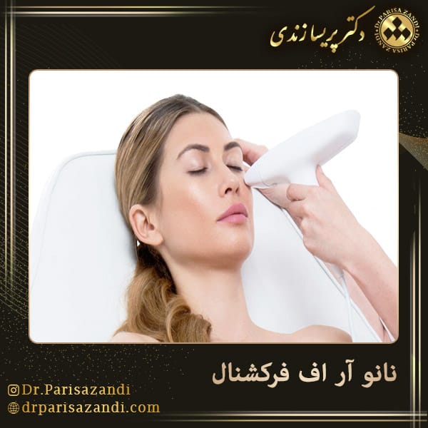 نانو آر اف فرکشنال