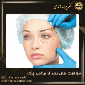 مراقبت های بعد از جراحی پلک - دکتر پریسا زندی