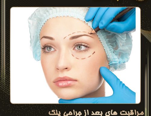 مراقبت های بعد از جراحی پلک