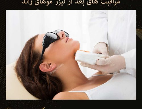 مراقبت های بعد از لیزر موهای زائد