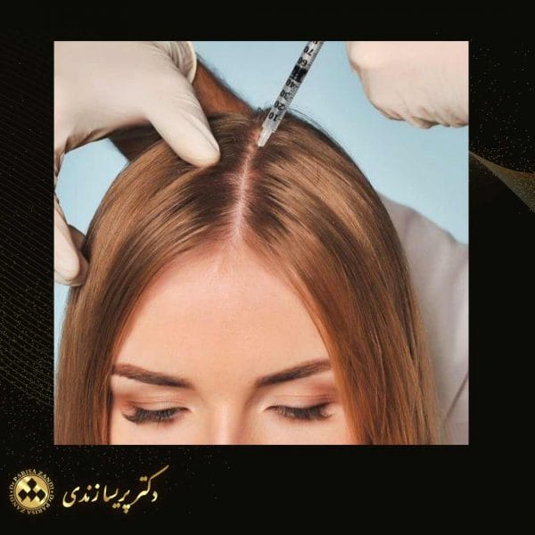 عکس پی آر پی مو و مراقبت های بعد از پی آر پی - دکتر پریسا زندی