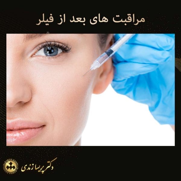 مراقبت های بعد از فیلر