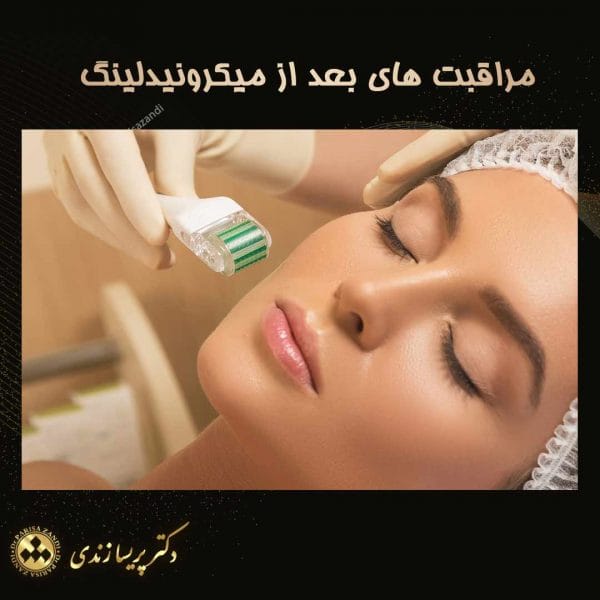 عکس مراقبت های بعد از میکرونیدلینگ - دکتر پریسا زندی
