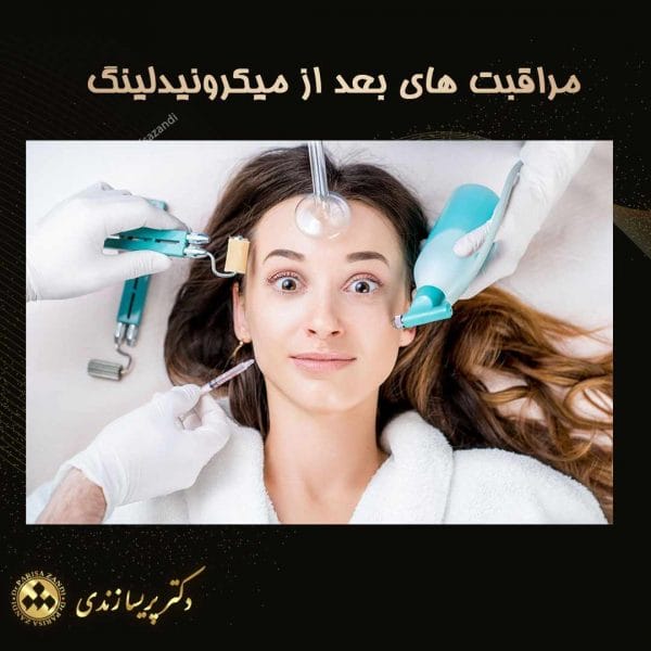 عکس مراقبت های بعد از میکرونیدلینگ - دکتر پریسا زندی