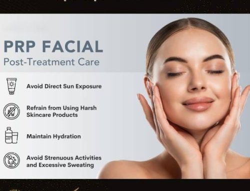 مراقبت های بعد از پی آر پی