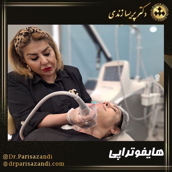 نحوه انجام هایفوتراپی صورت