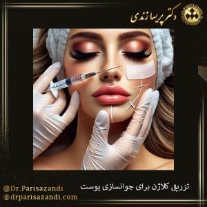 تزریق کلاژن برای جوانسازی پوست دکتر پریسا زندی