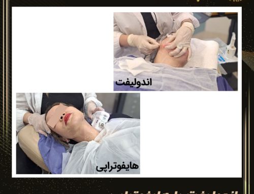 بهترین روش جوانسازی پوست کدام است؟ اندولیفت یا هایفوتراپی + مزایا