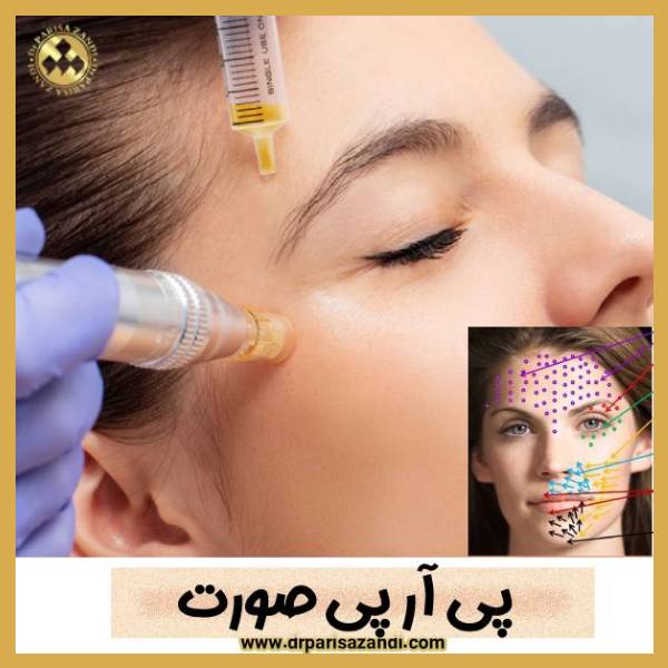 پی آر پی صورت - دکتر پریسا زندی