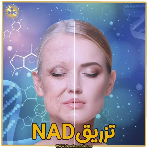 تزریق کاتالیزور NAD - دکتر پریسا زندی