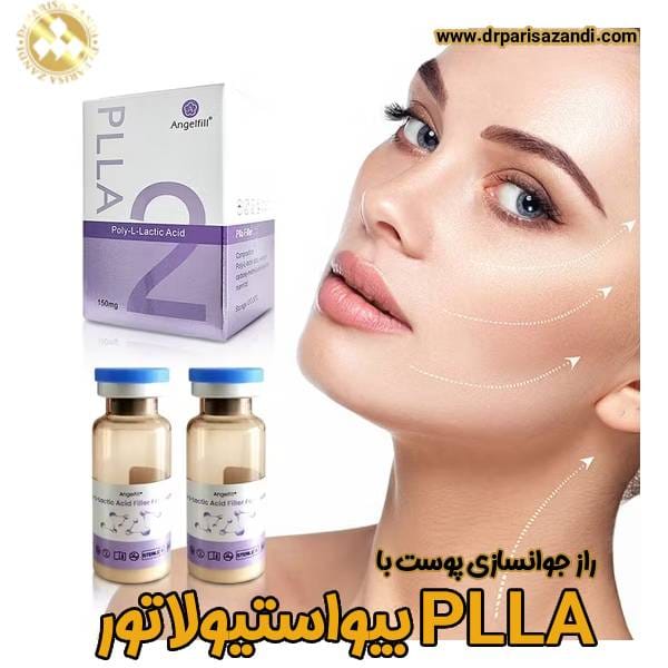 plla - دکتر پریسا زندی