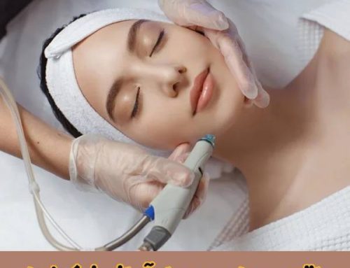 مراقبت‌ های بعد از آر اف (RF)