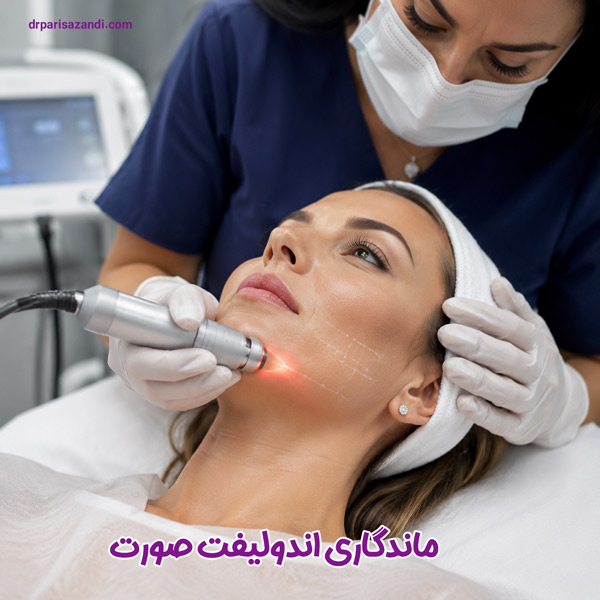 ماندگاری اندولیفت صورت - زندی