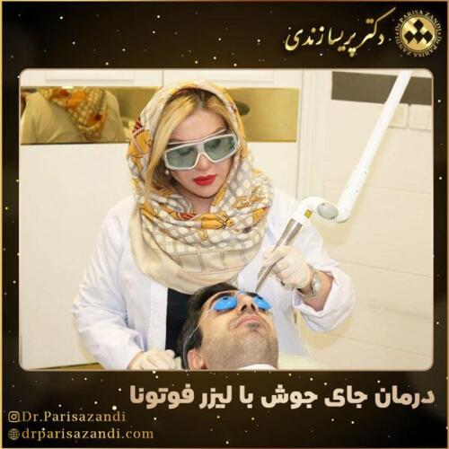 درمان-جای-جوش-7